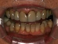 Konig Center for Cosmetic & Comprehensive Dentistry smile photos